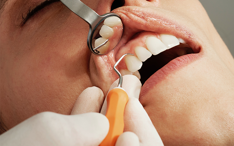 Great Ways to Save Money on Dental Care
